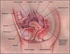 Ендометриоза, вътрешната обвивка на матката, лигавицата на матката, яйчници