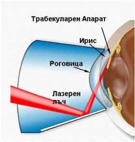 Глаукома, следствие от диабет, възпаления,  вътреочното налягане, диабет