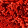 Какво трябва да знаете за бактерията листерия
