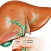 Терапия при чернодробни заболявания