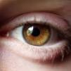 Пациенти искат касата да увеличи реимбурсацията на лекарствата за глаукома