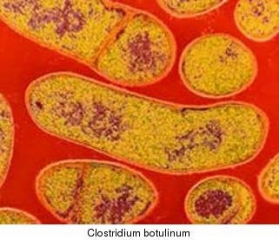 Ботулизъм,  бактериите, ботулиновия токсин,  имунитет